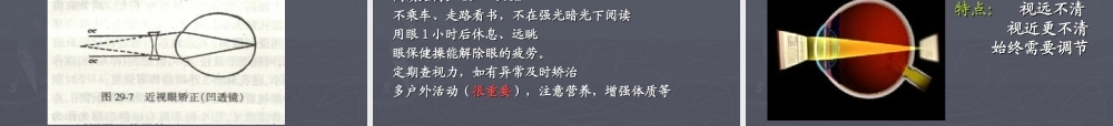 屈光不正-近视远视散光.ppt