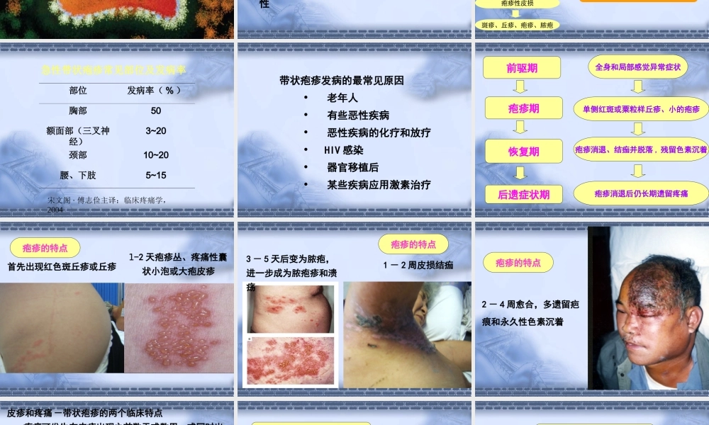 带状疱疹诊治.ppt