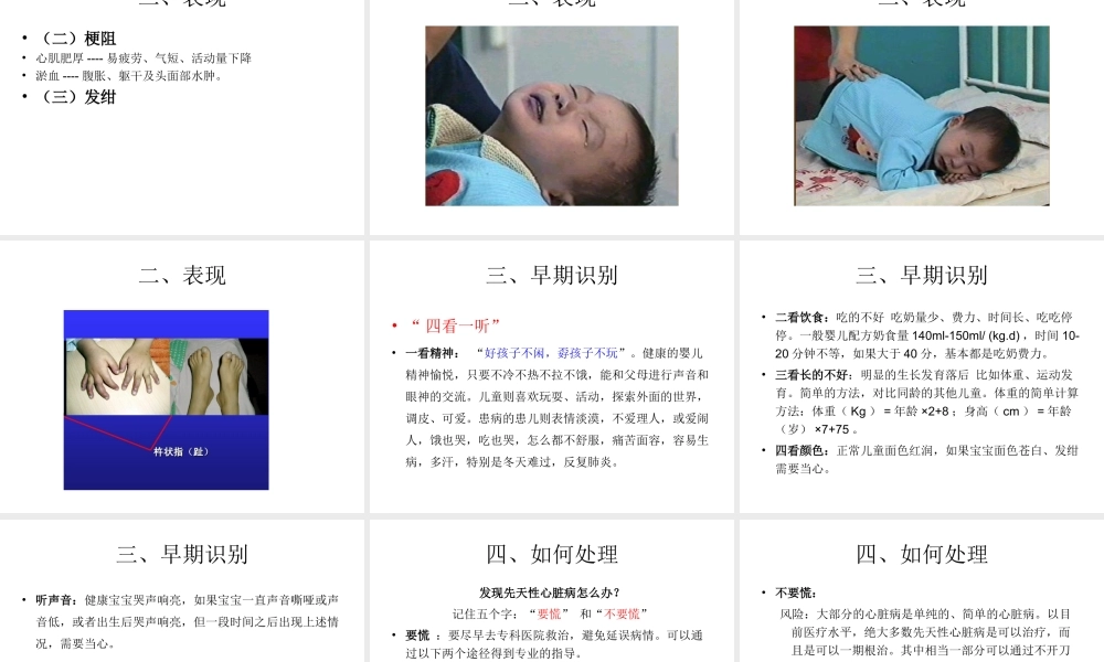 常见先天性心脏病的早期识别.ppt