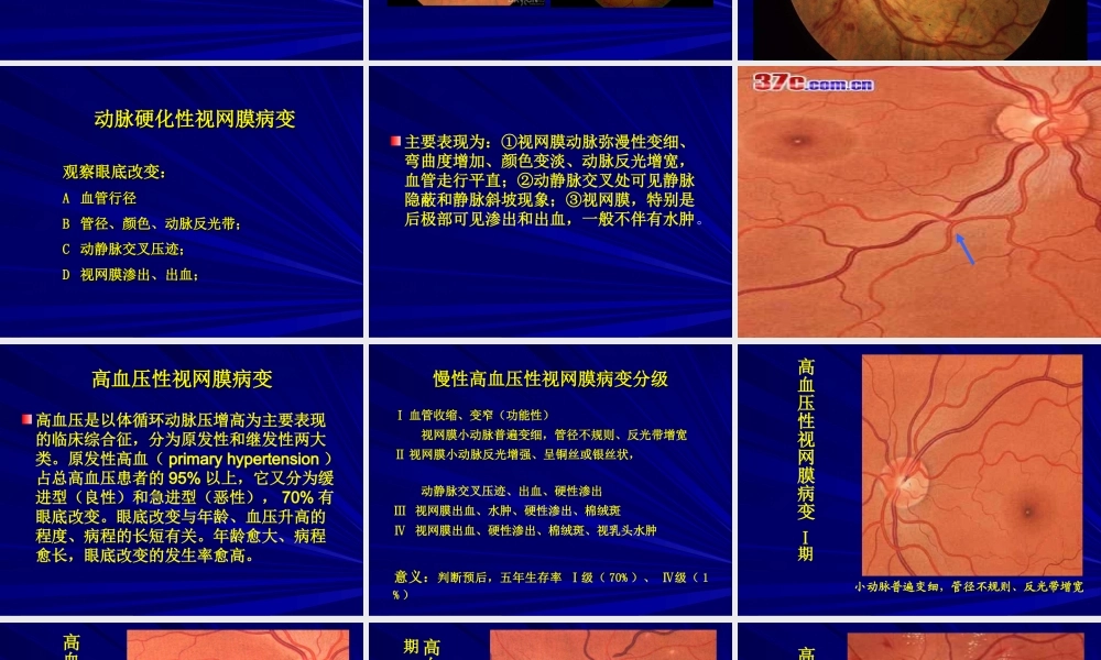 常见全身病的眼部表现.ppt