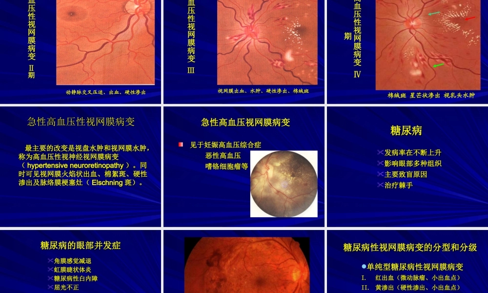 常见全身病的眼部表现.ppt