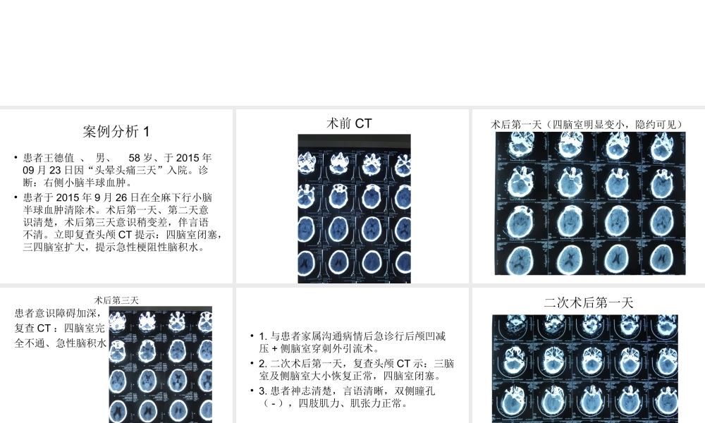 幕下术后发生急性梗阻性脑积水的思考与处理.ppt
