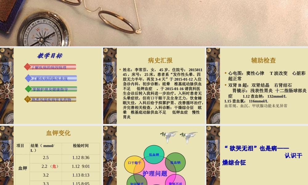 干燥综合征教学查房.ppt