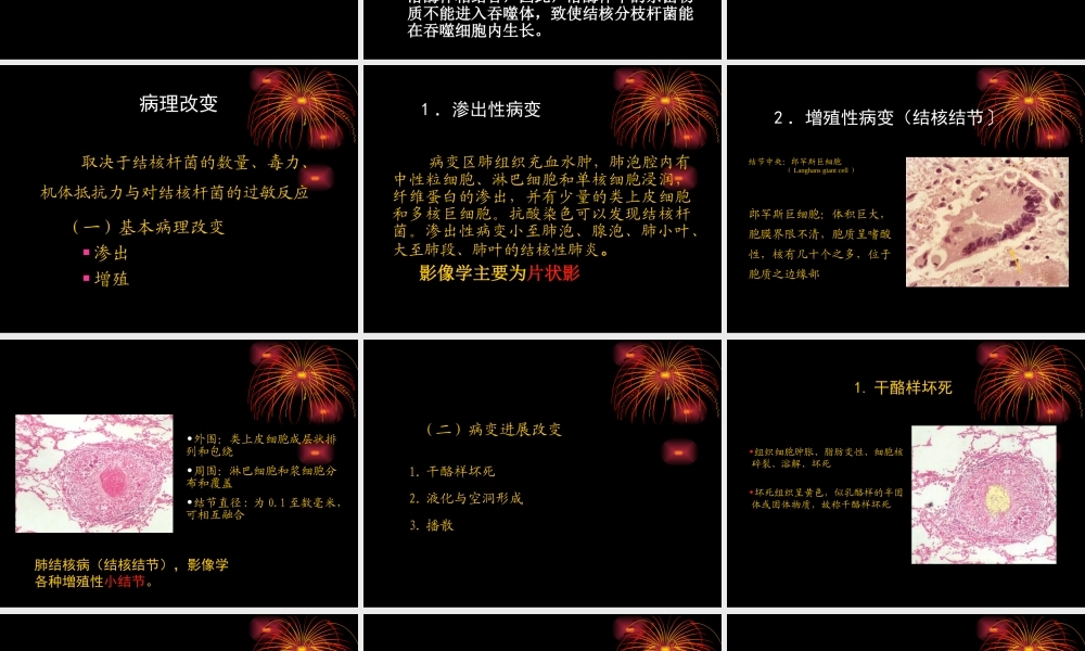 干酪性肺炎CT形态.ppt