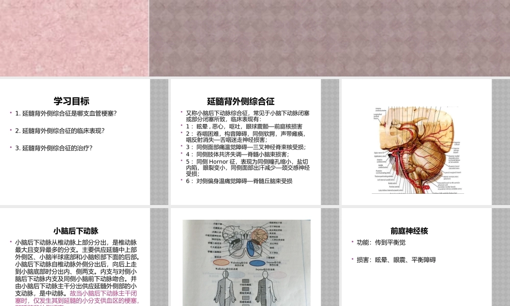 延髓背外侧综合症.pptx