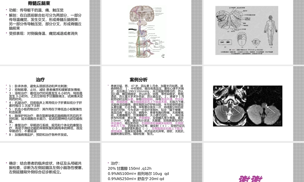 延髓背外侧综合症.pptx