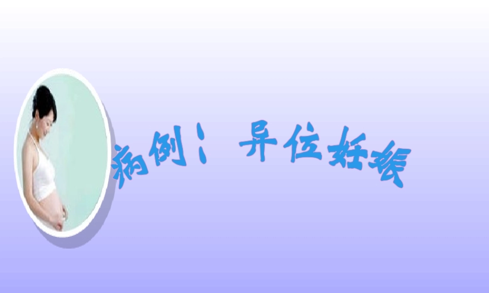 异位妊娠病例讨论ppt.ppt