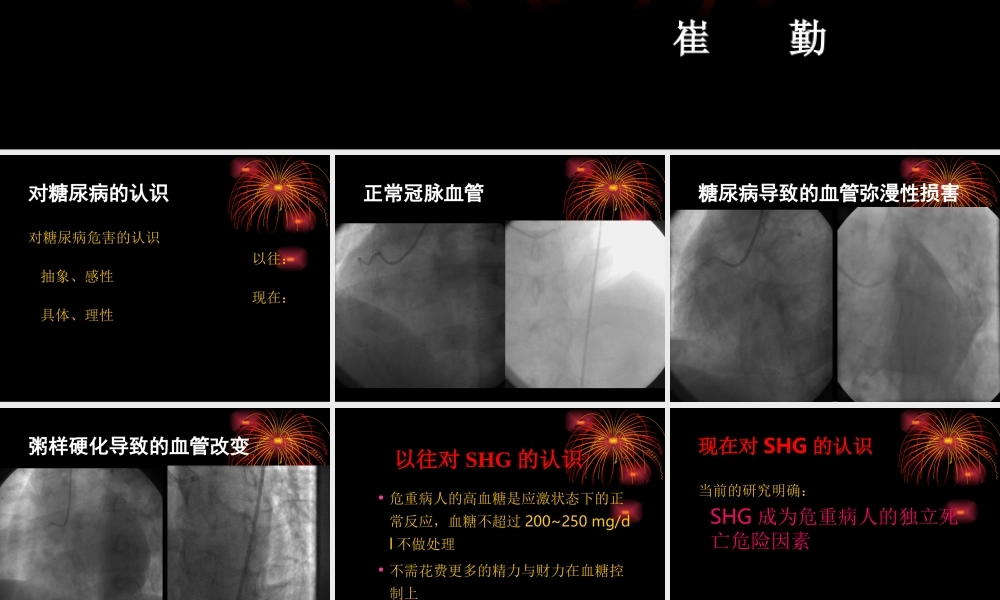 强化血糖控制.ppt