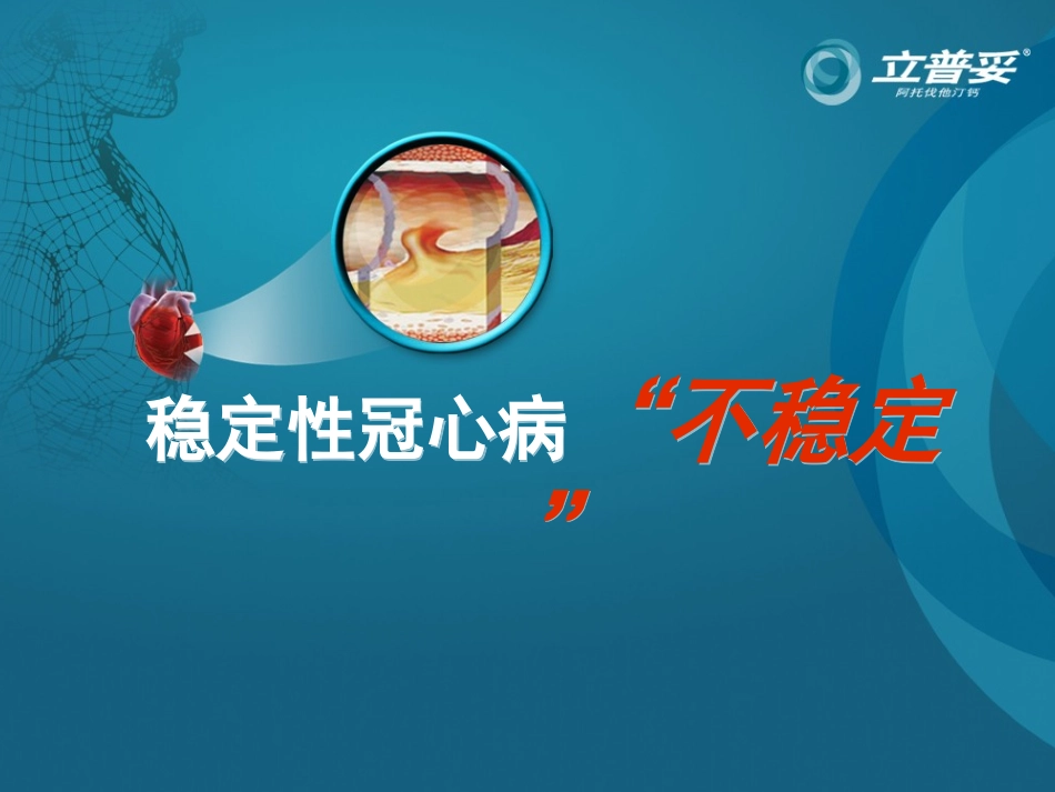 稳定性冠心病不稳定PIM.ppt_第1页