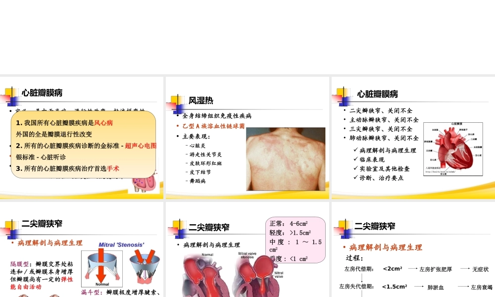 循环系统第6节-心脏瓣膜病.ppt