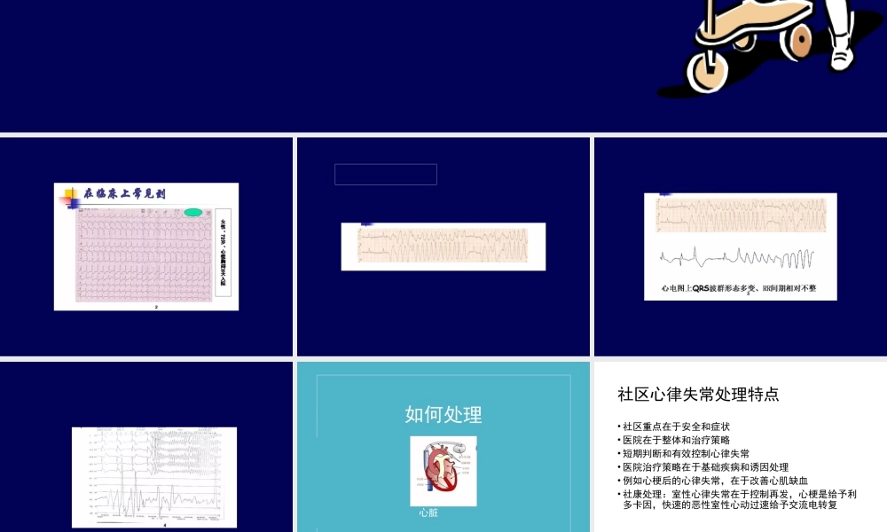 快速性心律失常急诊处理策略.ppt