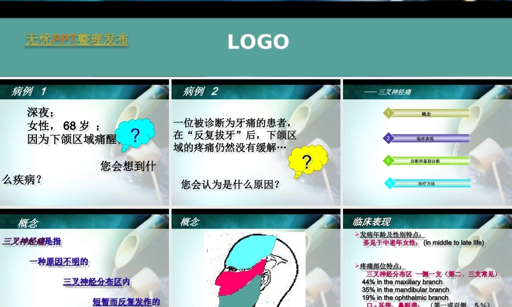 怎么分辨三叉神经痛、偏头痛、牙痛.ppt