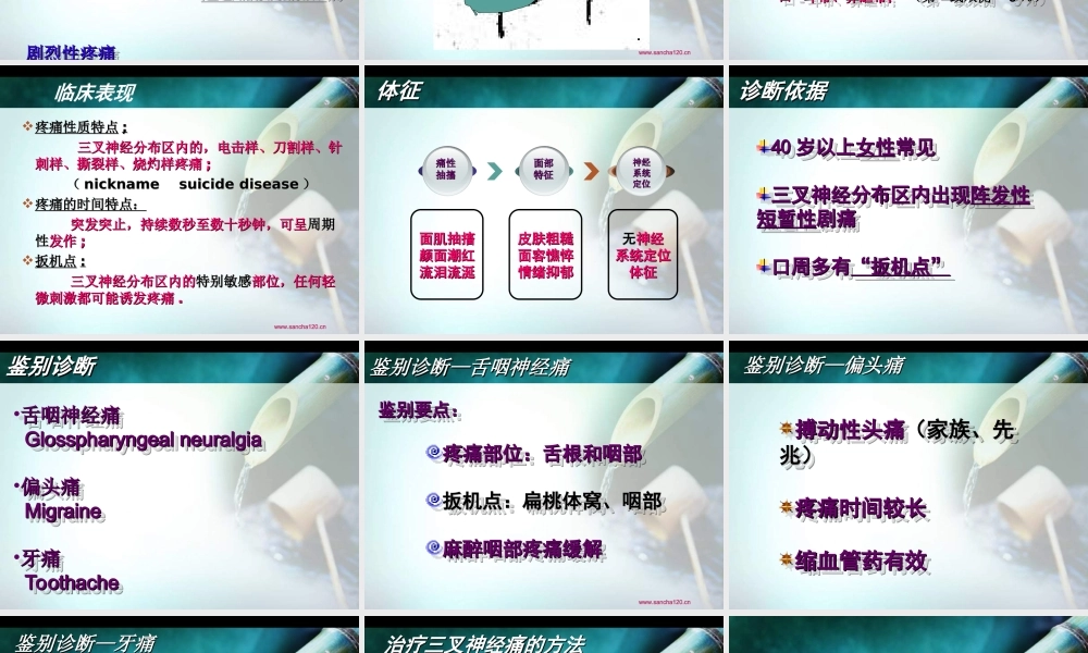 怎么分辨三叉神经痛、偏头痛、牙痛.ppt