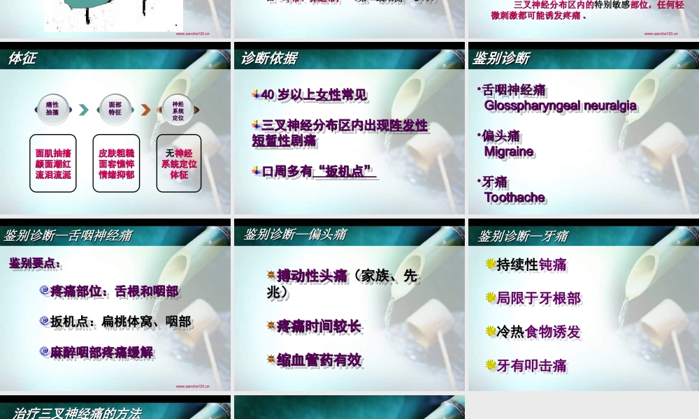 怎么分辨三叉神经痛偏头痛牙痛.ppt