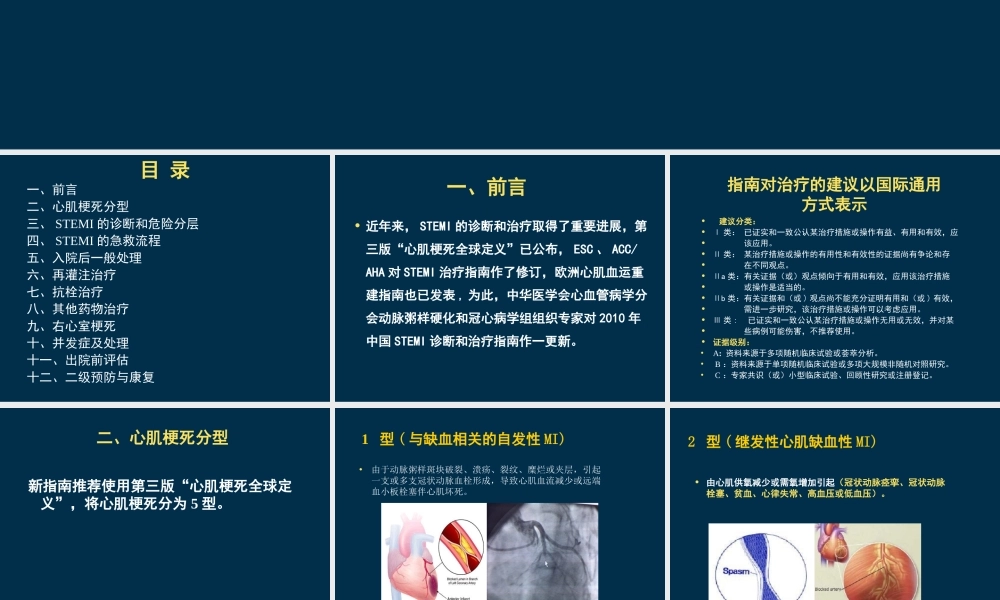 急性ST段抬高心肌梗死指南解读.ppt