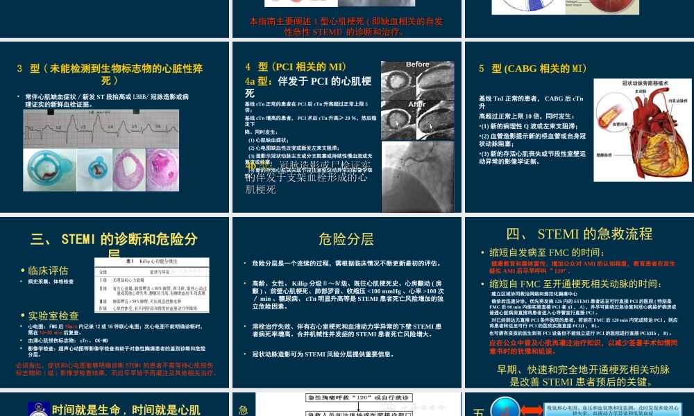 急性ST段抬高心肌梗死指南解读.ppt