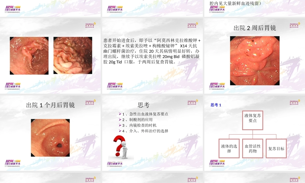 急性上消化道出血诊治体会.ppt