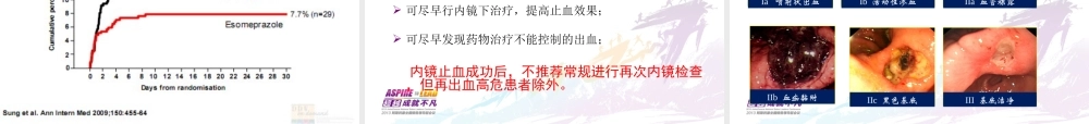 急性上消化道出血诊治体会.ppt