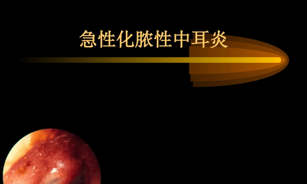 急性中耳炎的应急处理方法.ppt