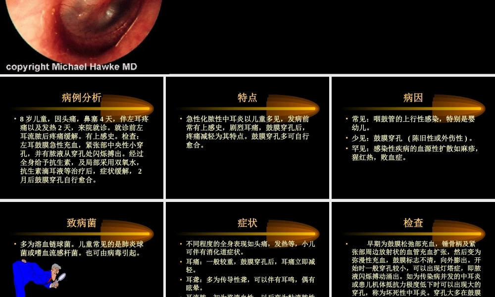 急性中耳炎的应急处理方法.ppt