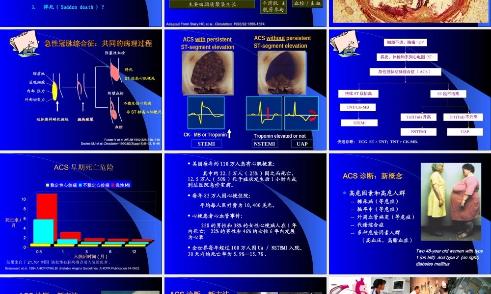 急性冠脉综合征诊治进展.ppt