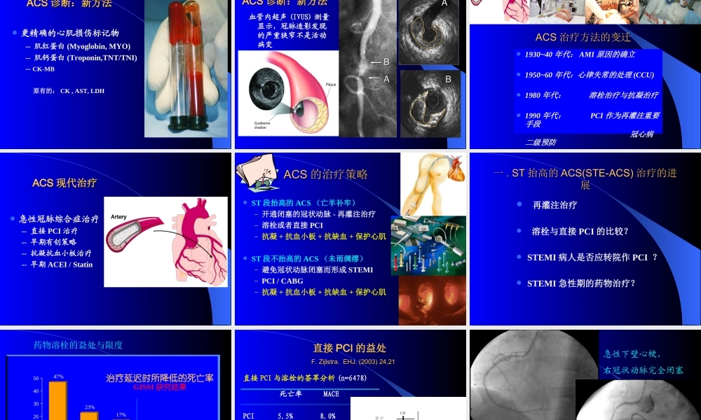 急性冠脉综合征诊治进展.ppt