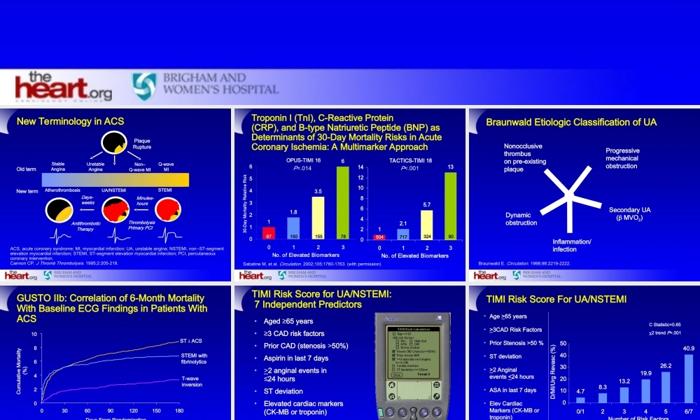 急性冠脉综合征评估及危险分层.ppt