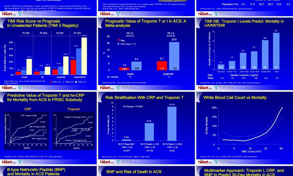 急性冠脉综合征评估及危险分层.ppt