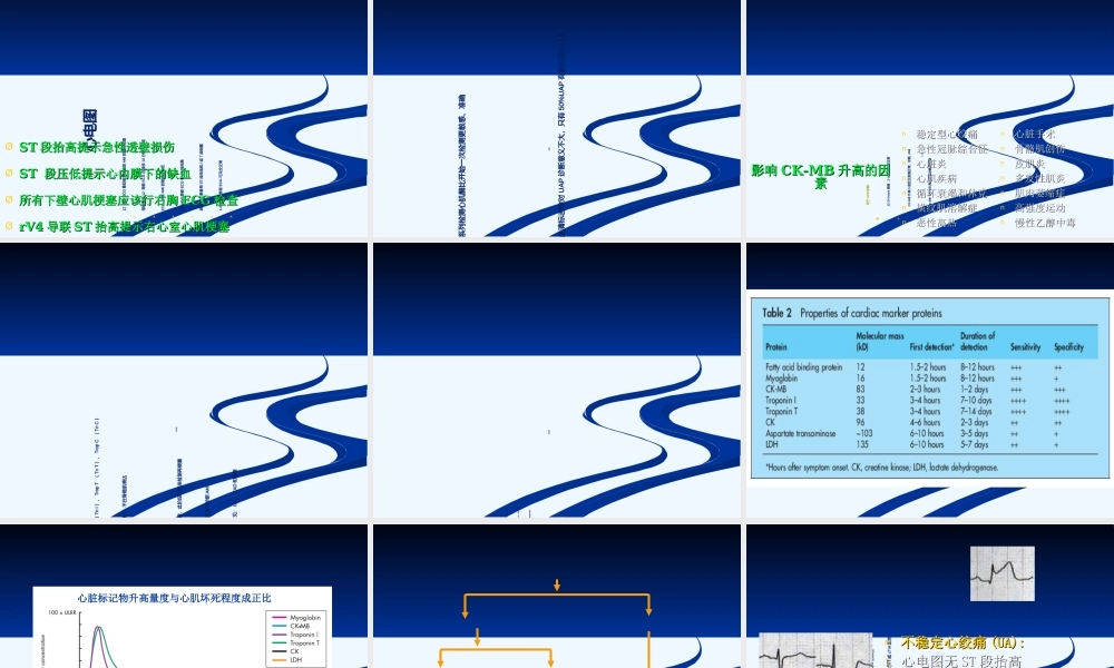 急性冠脉综合症-tr.ppt