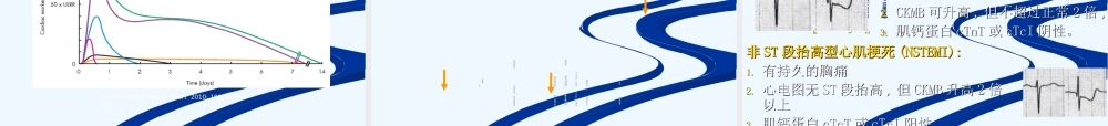 急性冠脉综合症-tr.ppt