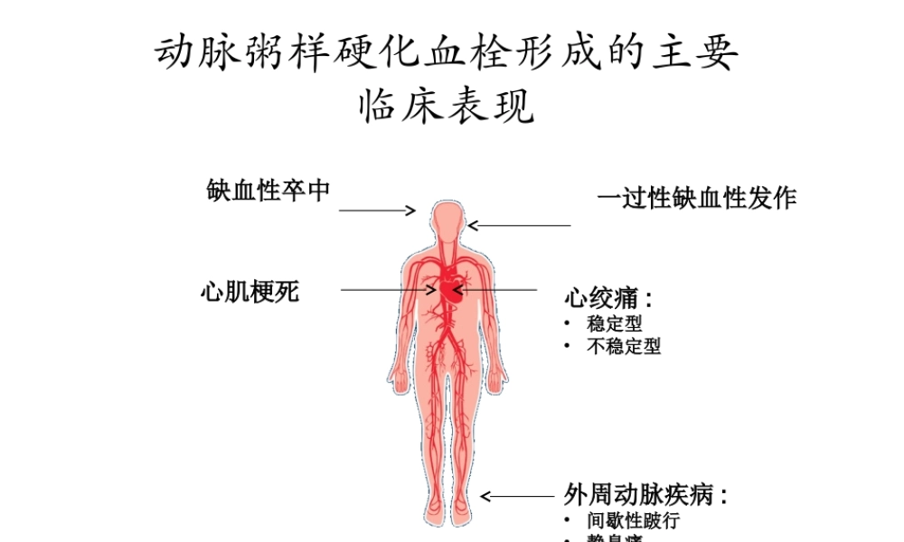 急性冠脉综合症的.ppt
