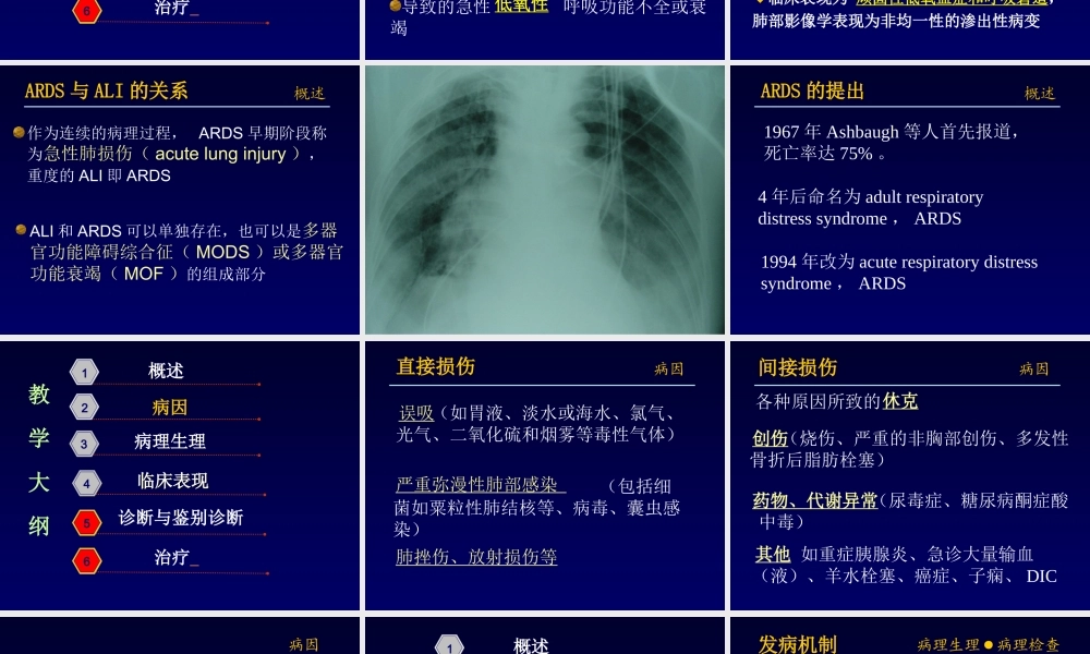 急性呼吸窘迫.ppt