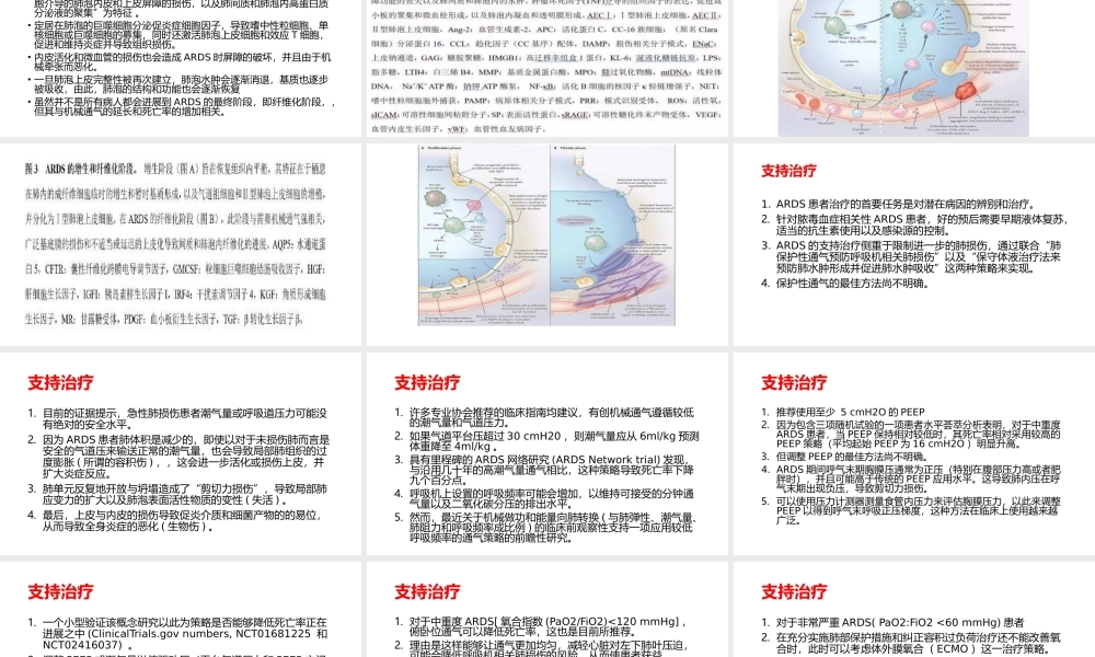 急性呼吸窘迫综合征.pptx