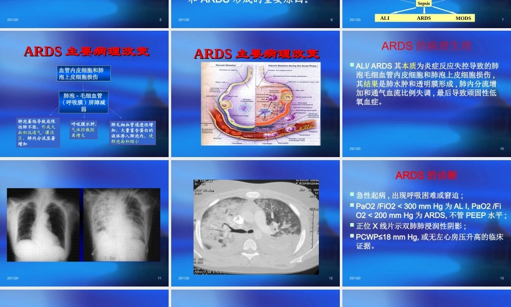 急性呼吸窘迫综合征9.ppt