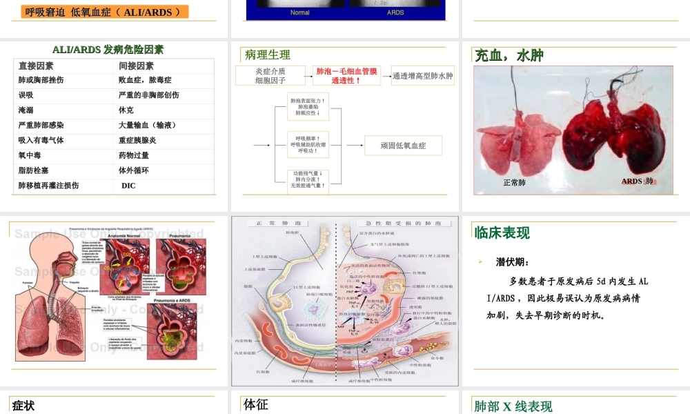 急性呼吸窘迫综合症新.ppt