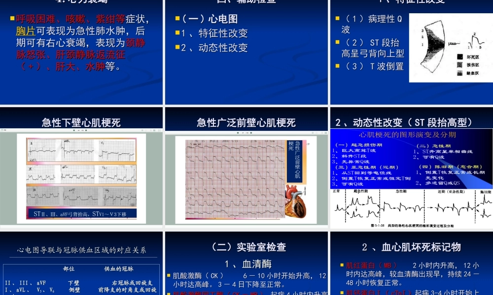 急性心肌梗死-mj.ppt