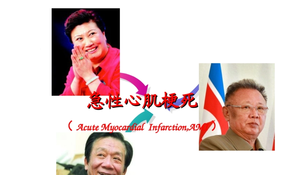 急性心肌梗死-新.ppt
