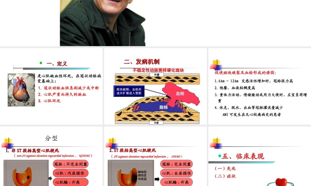 急性心肌梗死-新.ppt