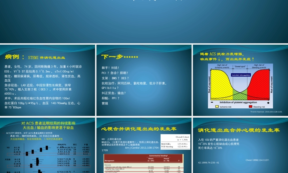 急性心肌梗死合并消化道出血的防治策略.pptx