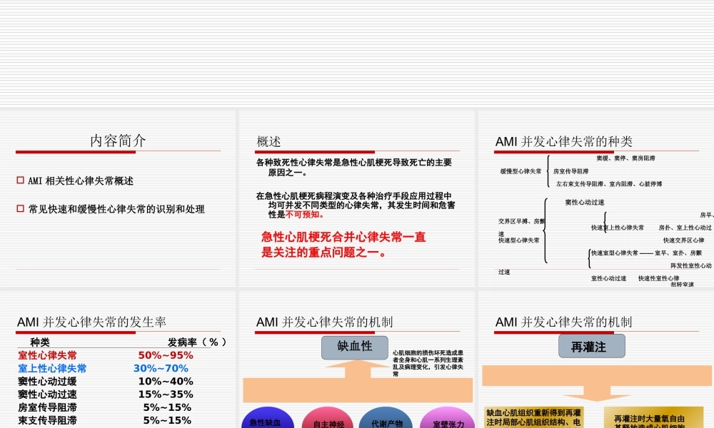 急性心梗并发心律失常的诊治.ppt