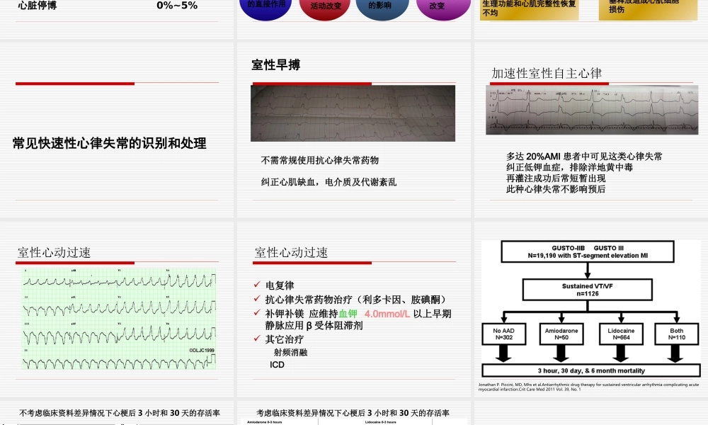急性心梗并发心律失常的诊治.ppt