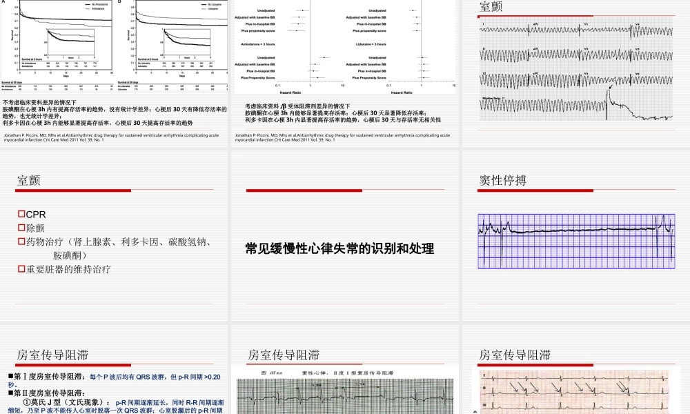 急性心梗并发心律失常的诊治.ppt