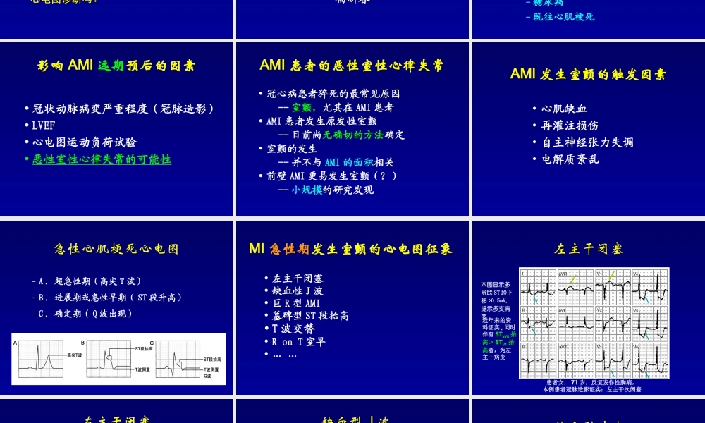 急性心肌梗死猝死的心电图.ppt