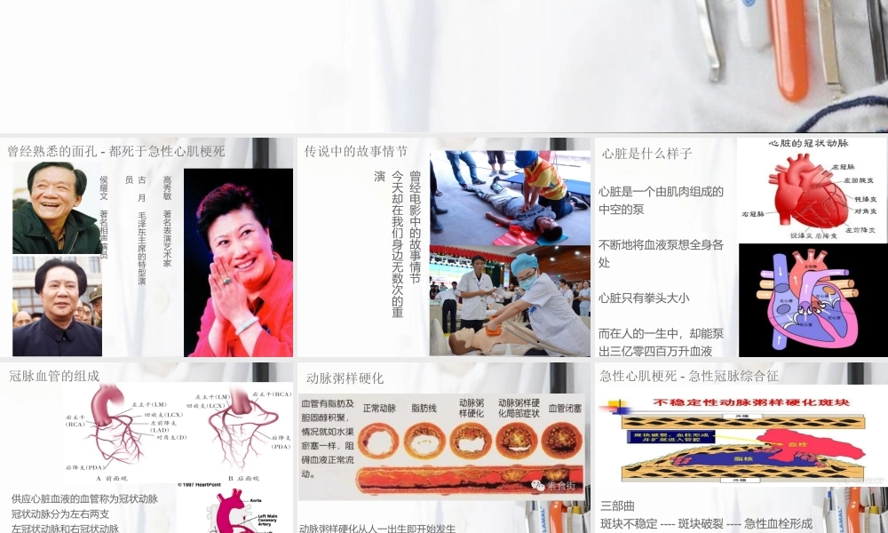 急性心肌梗死科普.ppt