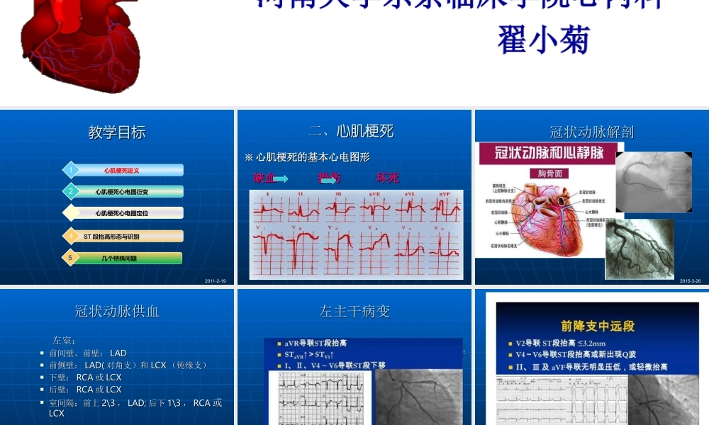 急性心肌梗死的心电图演变.ppt
