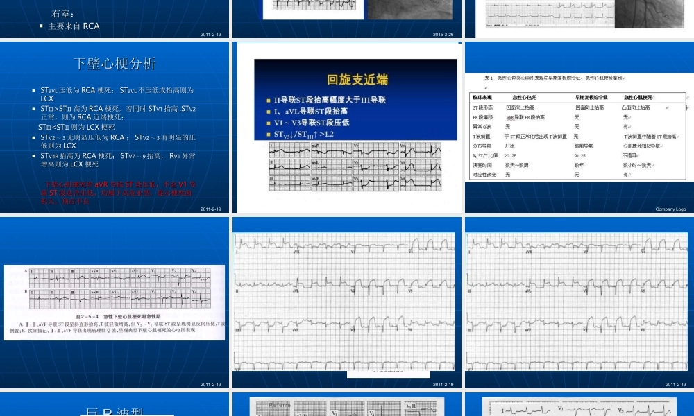 急性心肌梗死的心电图演变.ppt