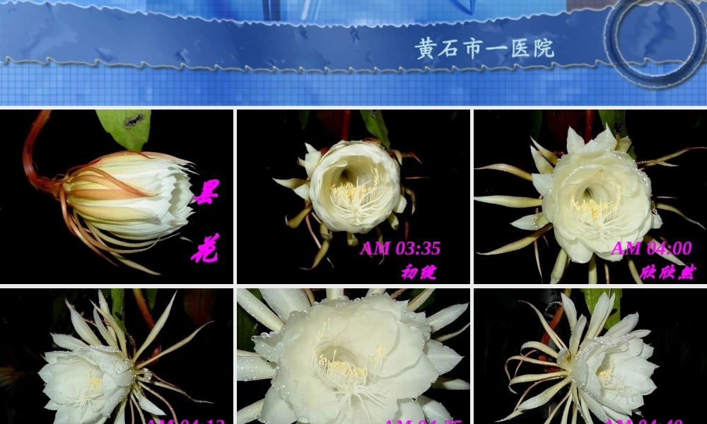 急性慢性支气管炎sss.ppt