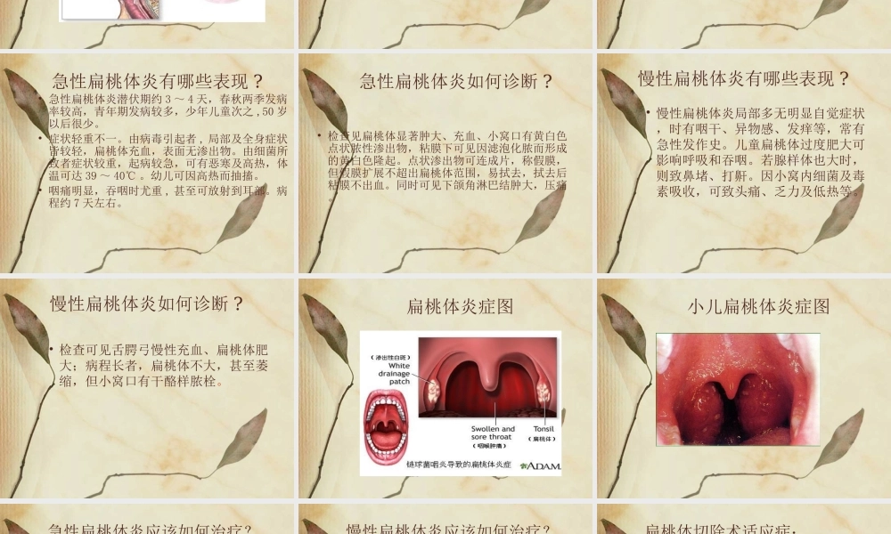 急性扁桃体炎.ppt