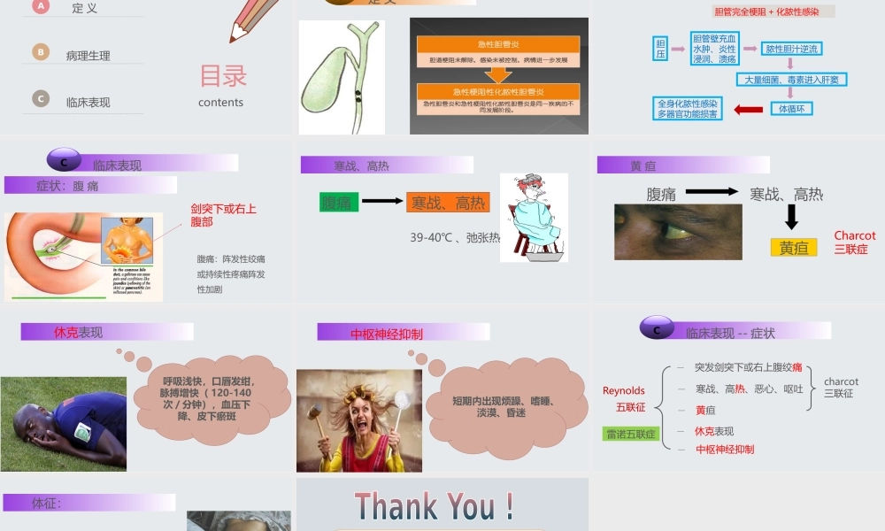 急性梗阻化脓胆管炎.pptx