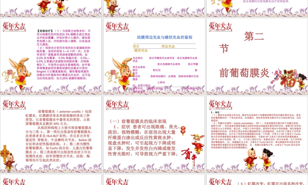 急性结膜炎、急性虹膜炎、急性闭角型青光眼.ppt